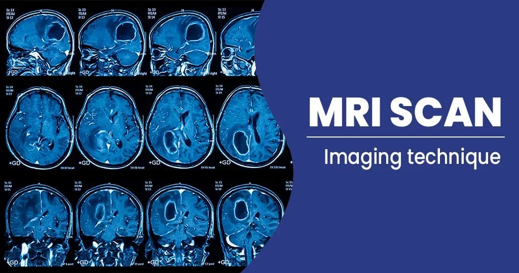 MRI Scan - Uses, Procedures, Side effects, and more