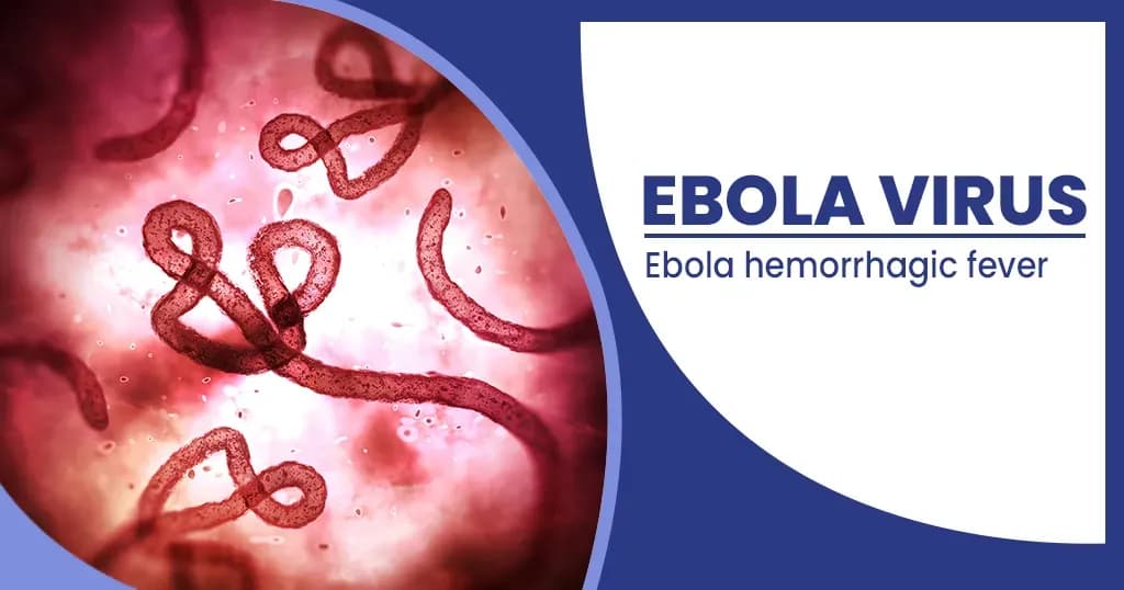 Ebola virus – Symptoms, Causes, Treatments, and Prevention