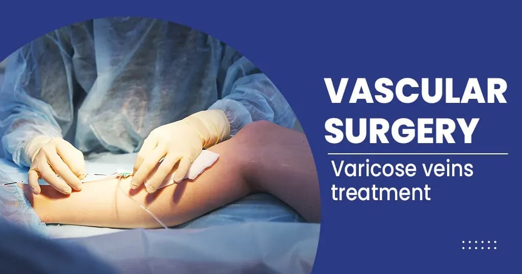 What is Vascular surgery? 