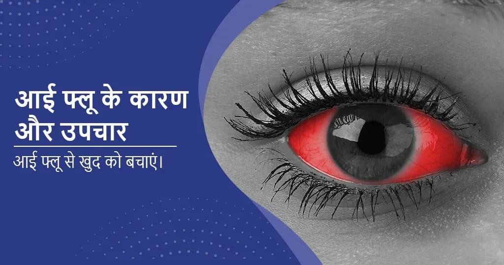 नेत्र फ्लू (आई फ्लू) का कारण और इलाज क्या है?