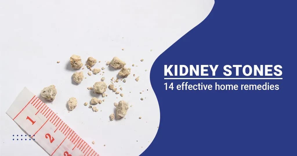 14 Natural home remedies for kidney Stones