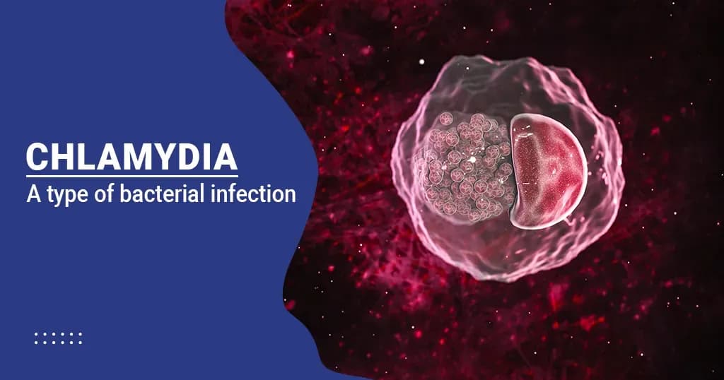 Chlamydia - Treatment, Causes, Symptoms, And Prevention