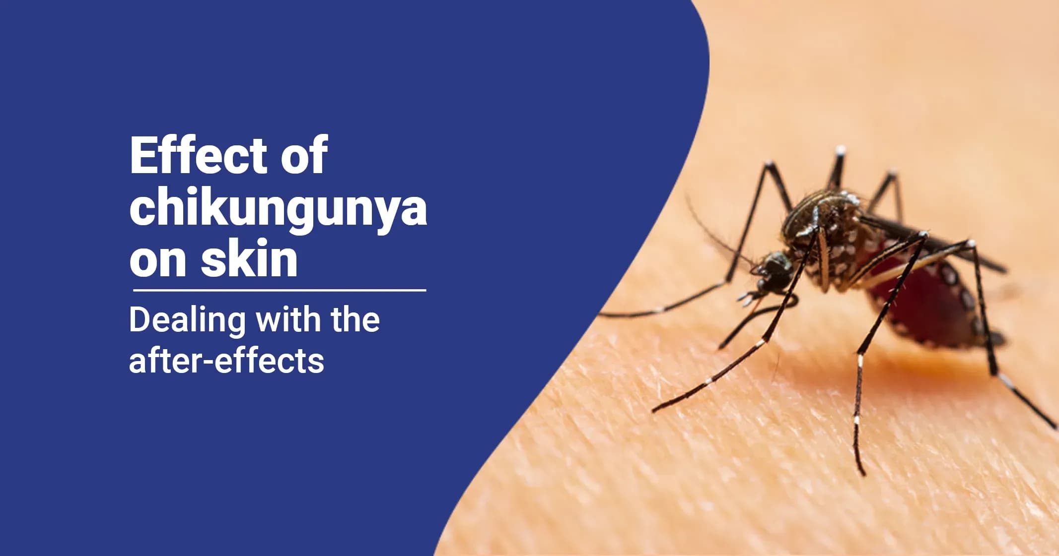 Chikungunya Effect on Skin: What You Need to Know