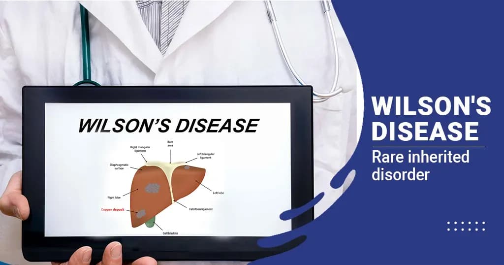 Wilson's Disease - Causes, Symptoms, Treatments, and More