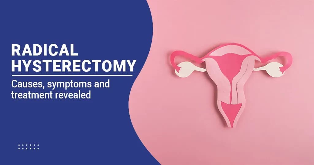 Radical Hysterectomy - Causes, Symptoms and Treatment