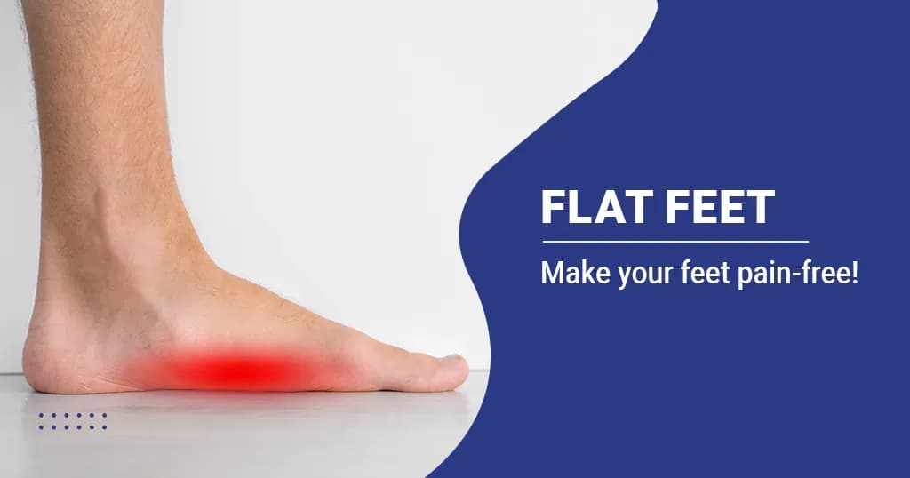 Flat Feet - Causes, Symptoms &amp; Treatment