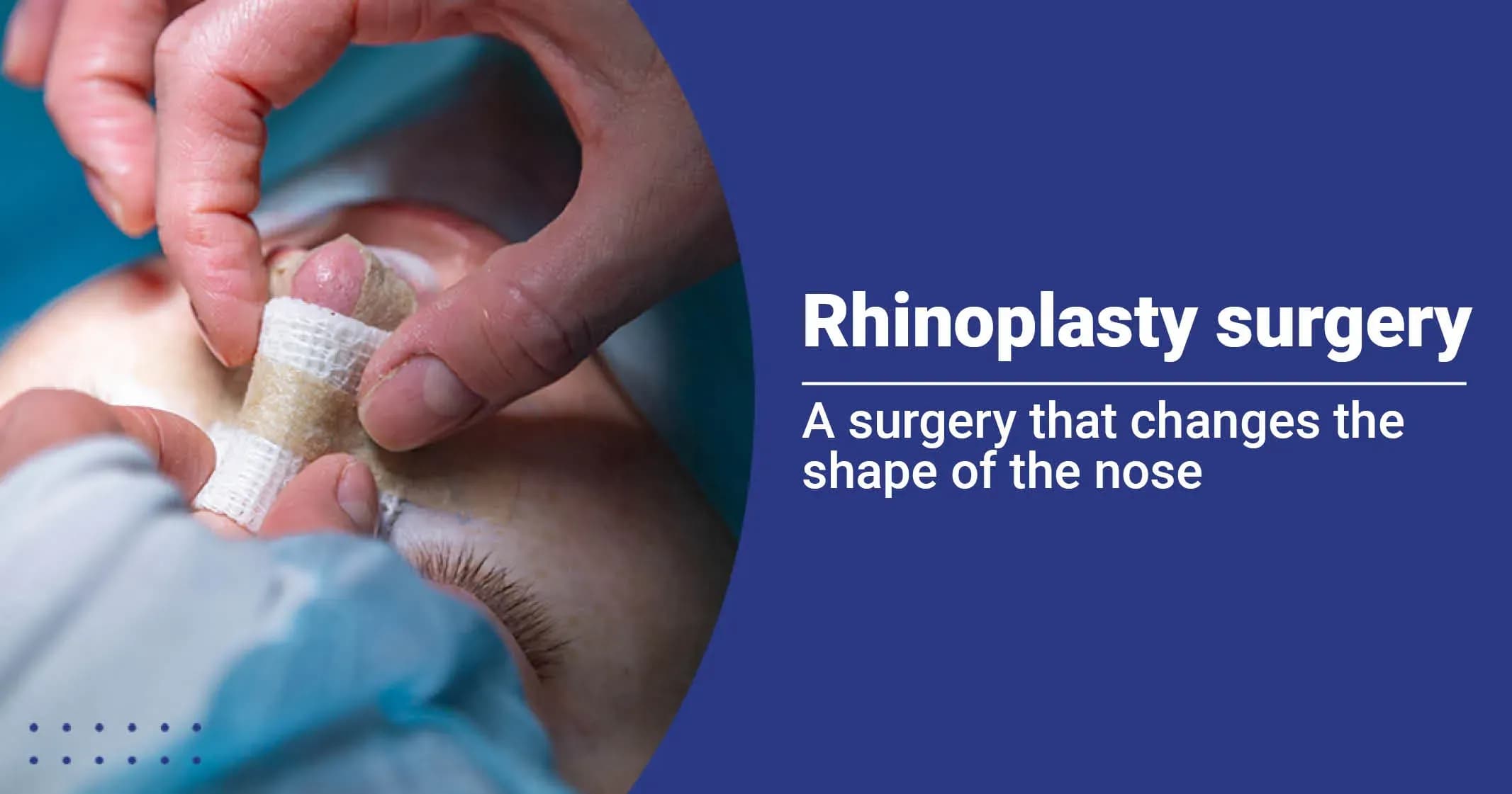 Know All About Nose Job- Rhinoplasty Surgery