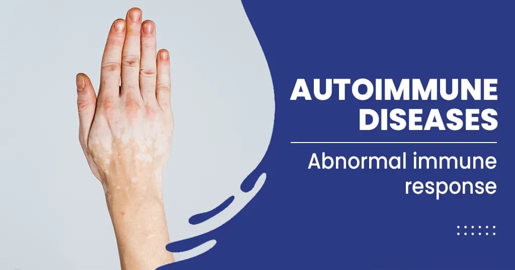 Autoimmune Diseases: Symptoms and Causes