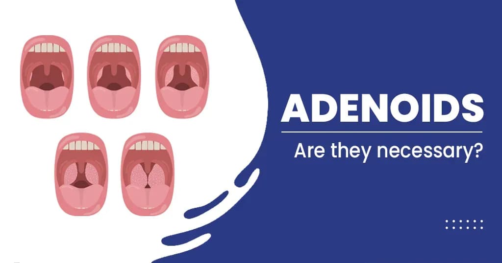 Adenoids - Are they necessary?