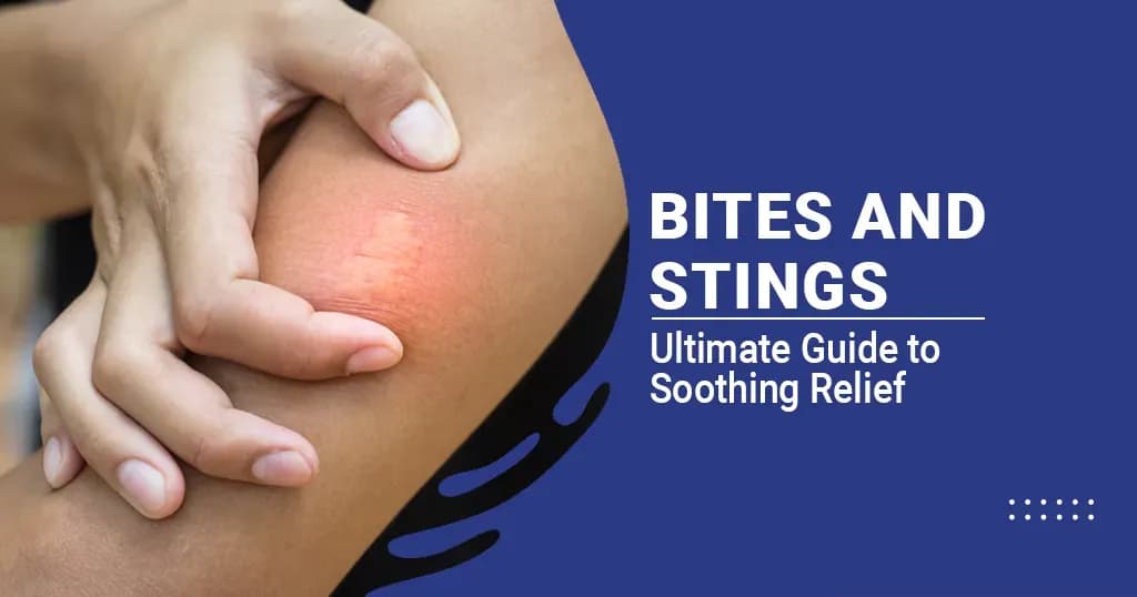 Bites and Stings: Causes and Symptoms