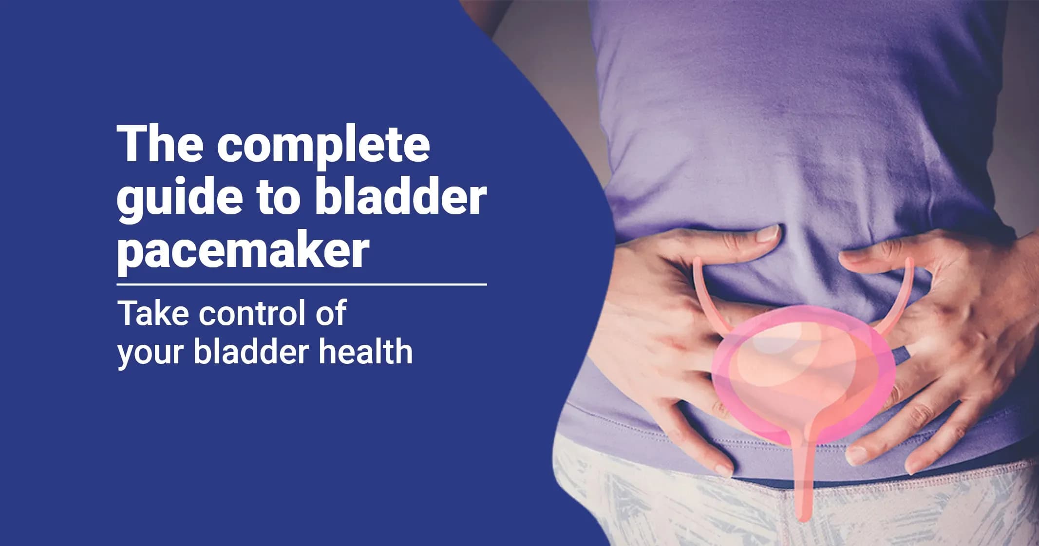 Bladder Pacemaker Complete Guide: Everything you need to know 