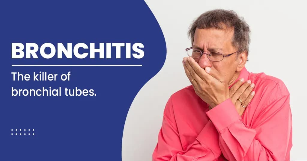 Bronchitis: Symptoms, causes & treatment