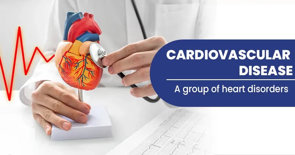 Cardiovascular diseases – Causes, Diagnosis, and Treatment