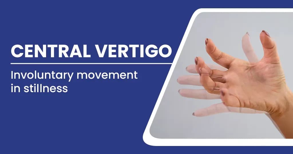 Central Vertigo – Causes, Symptoms, Treatments and more