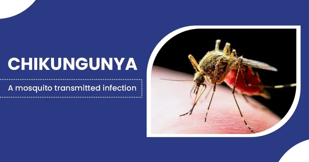 Chikungunya – Symptoms, diagnosis, treatment and prevention