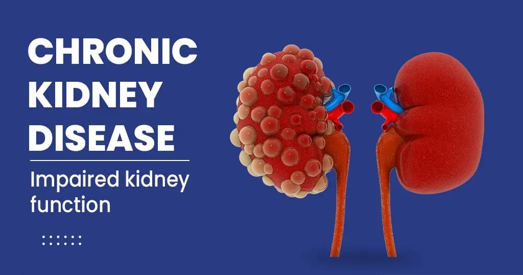 Chronic Kidney Disease - Symptoms, Risk Factors and More