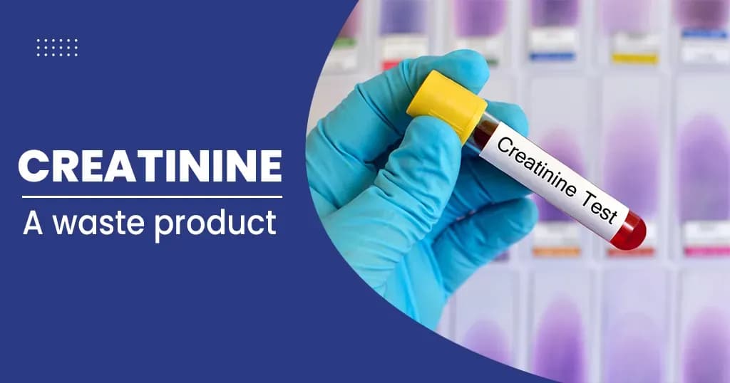 Creatinine test – Normal level