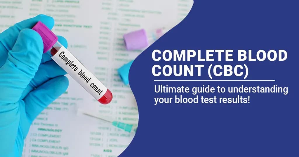 Complete Blood Count (CBC) -What does it show about your health