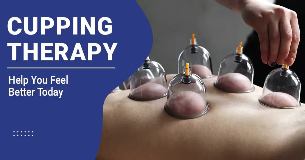 Cupping therapy - Types, Benefits and Side Effects 