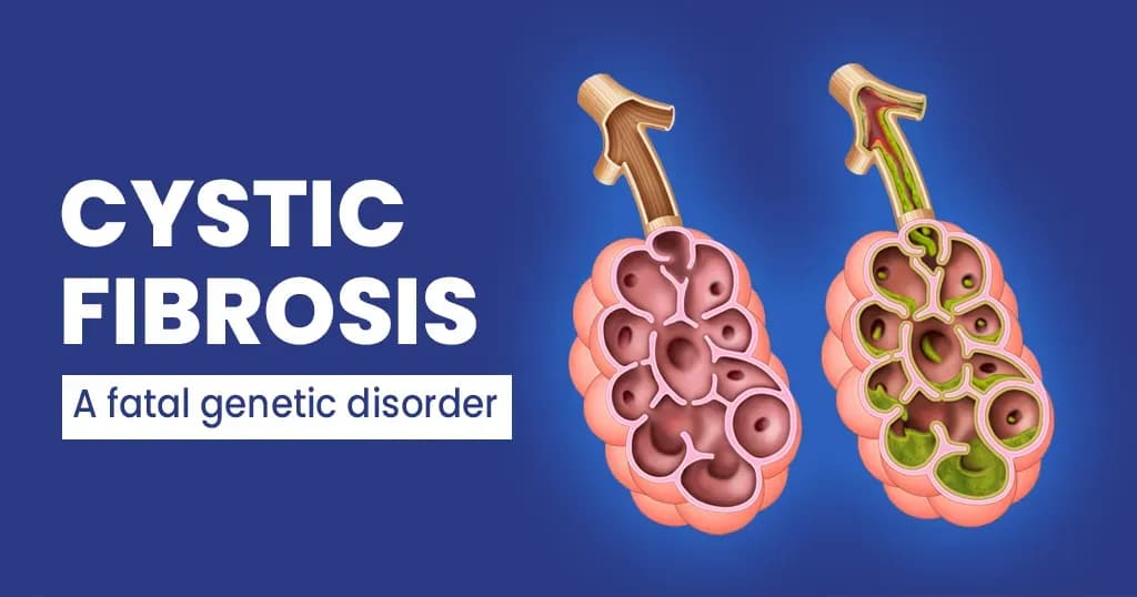 Cystic Fibrosis - Causes, symptoms and treatment