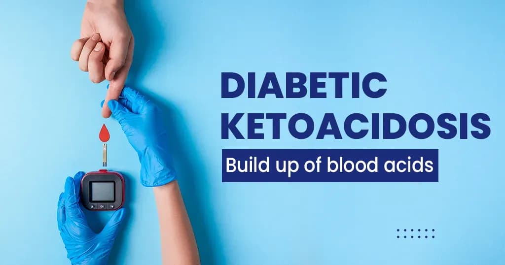 Diabetic Ketoacidosis - Symptoms, causes, risk factors, prevention and more