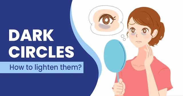 How to get rid of dark circles