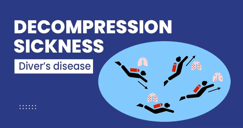 Decompression sickness