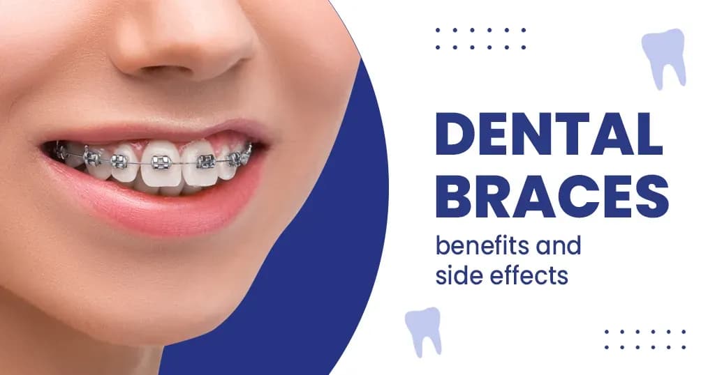 Braces benefits and side effects