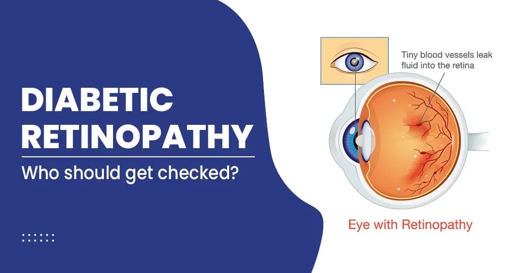 DIABETIC RETINOPATHY