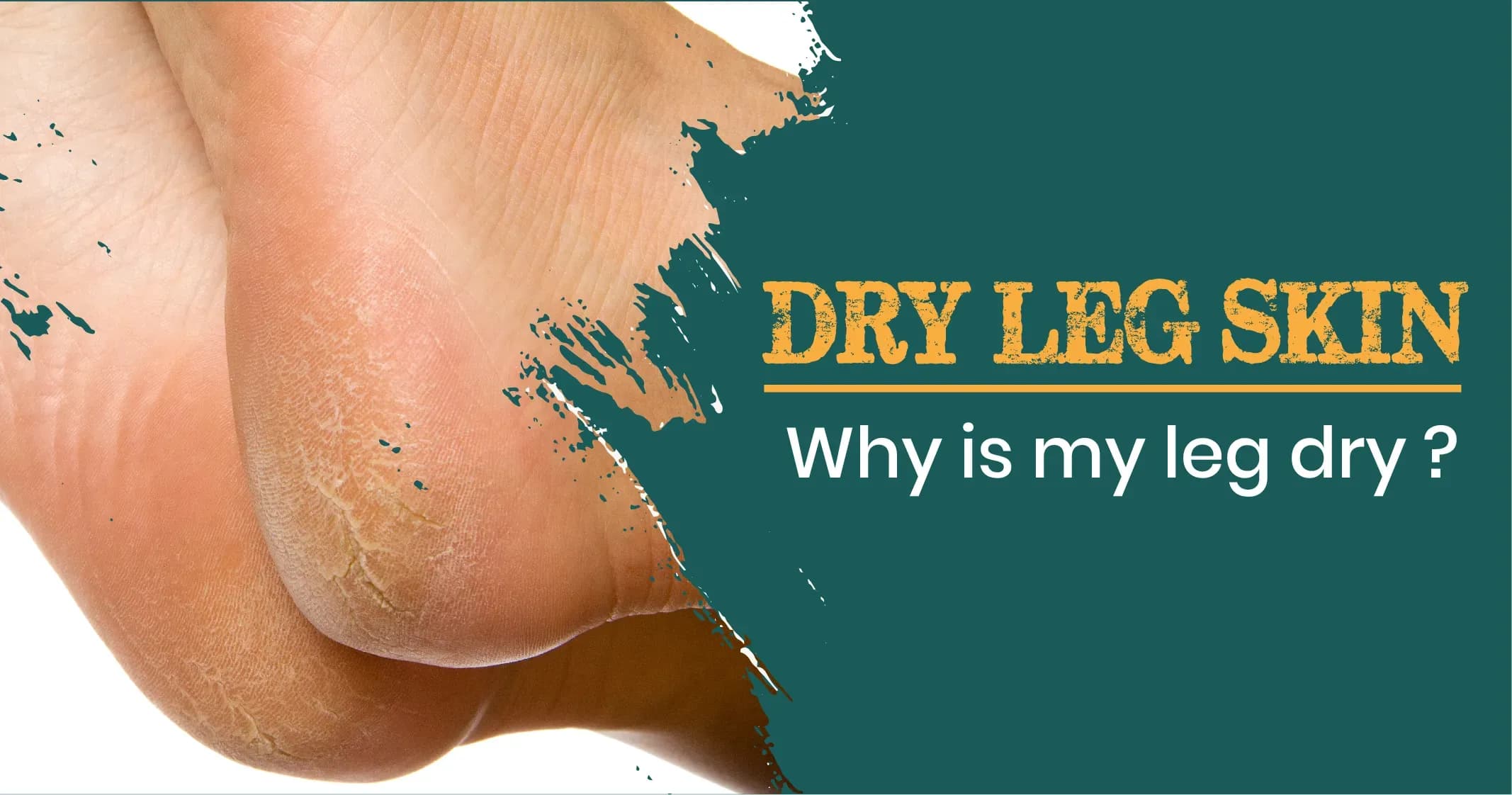 Dry Leg Skin - How to get rid of it?