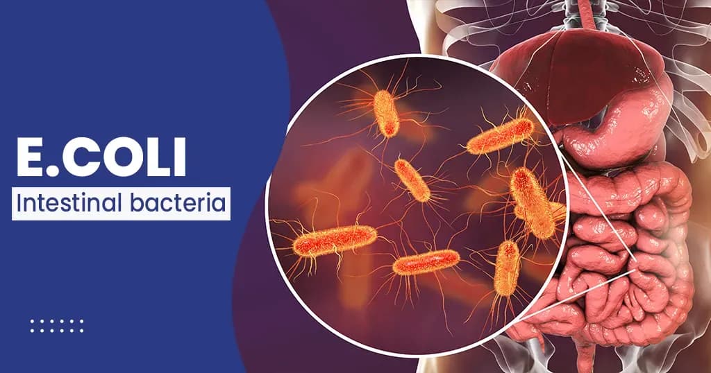 E. coli bacterial Infection - Causes, Symptoms, and Treatments