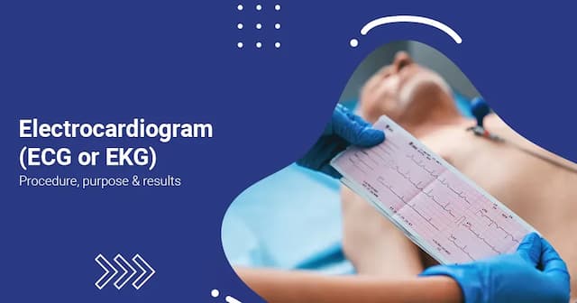 Electrocardiogram - Procedure, Purpose & Results