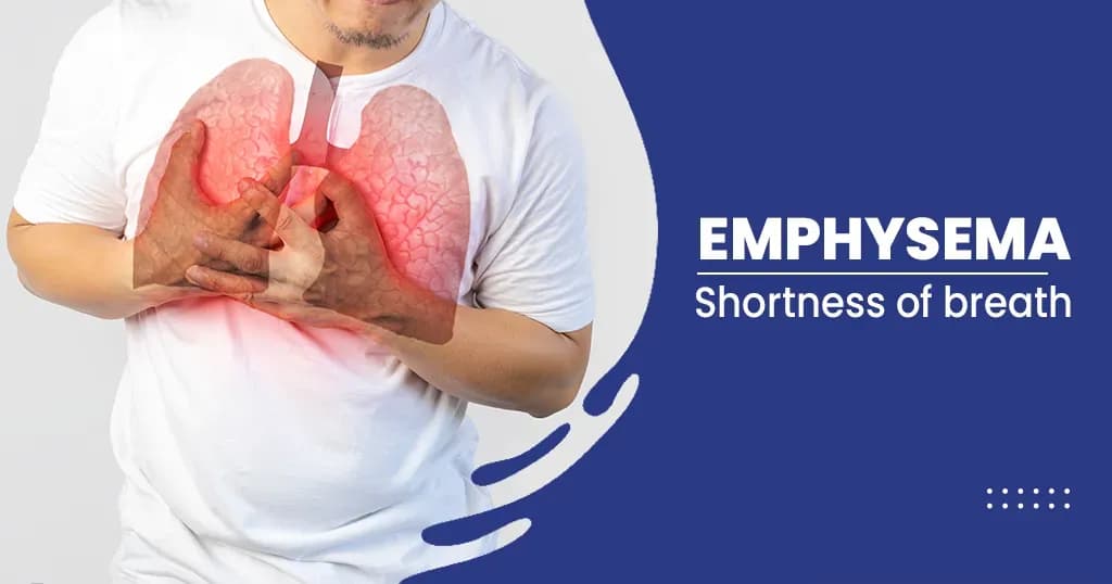 Emphysema: What is it? Causes, Symptoms, and More