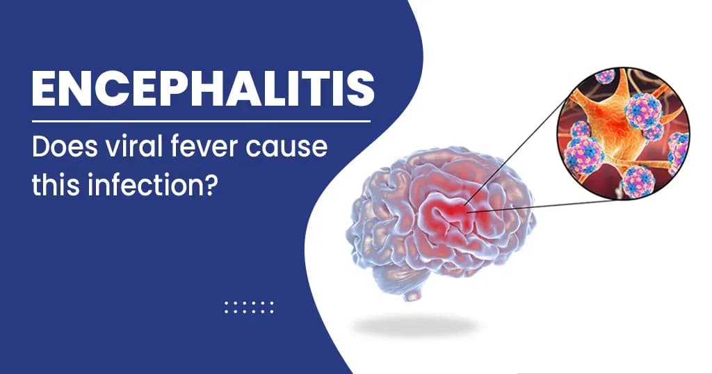 Encephalitis- Risk factors, causes, and treatments