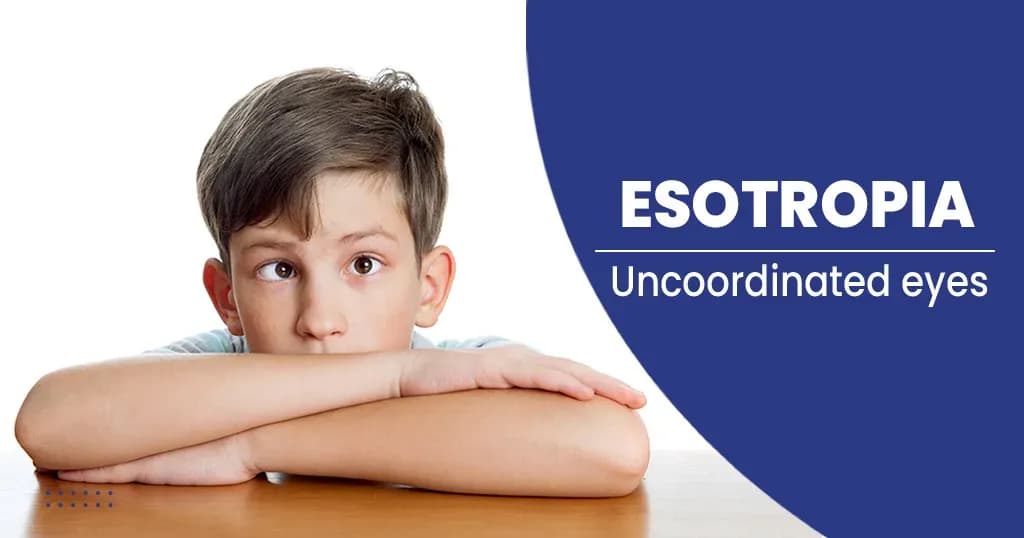 Esotropia – Types, Causes, Symptoms, and More