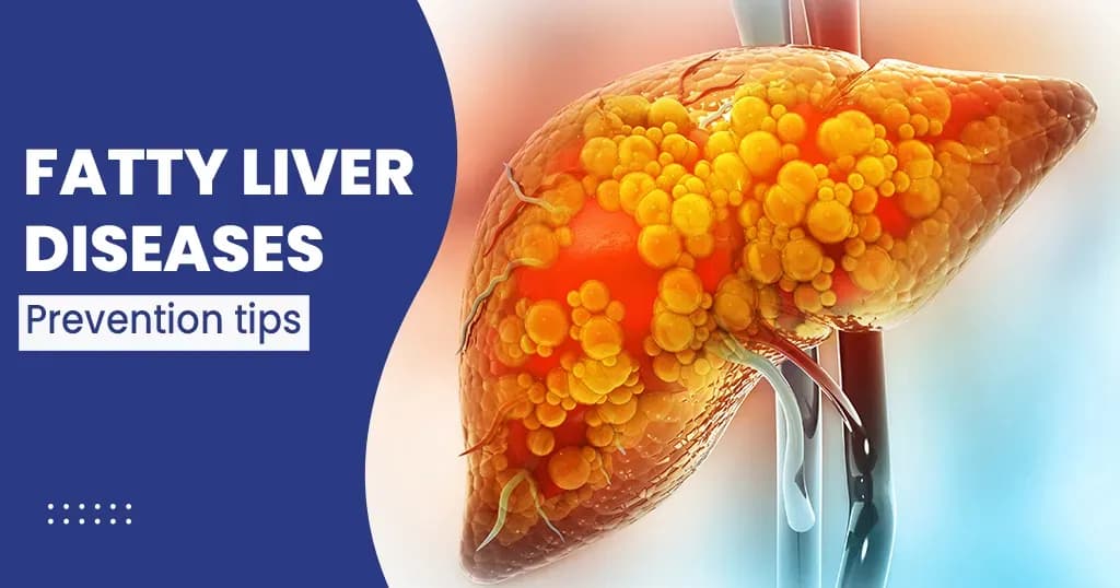 Diet for fatty liver disease 