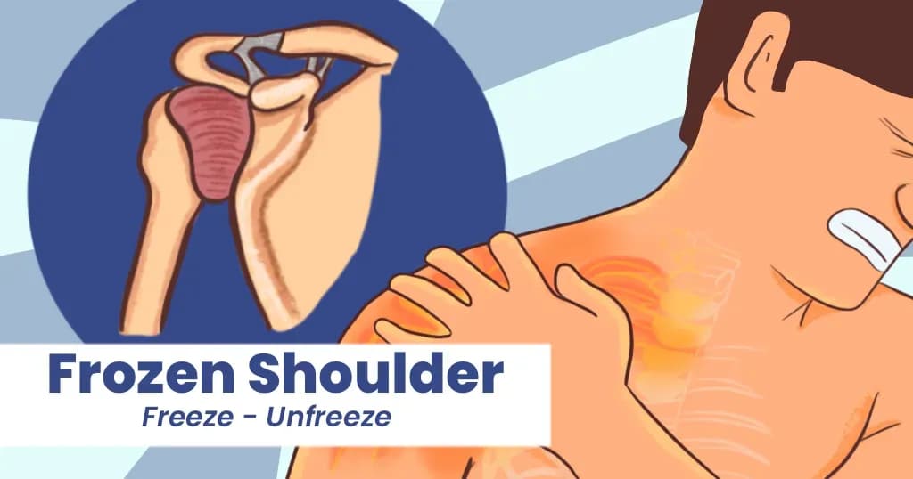 How to cure frozen shoulder quickly