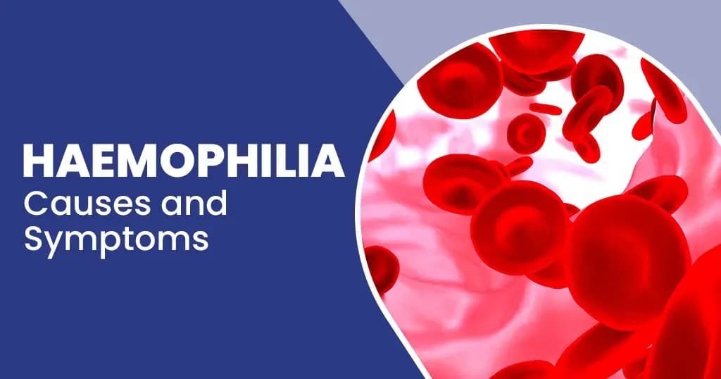 Haemophilia - Causes and Symptoms 