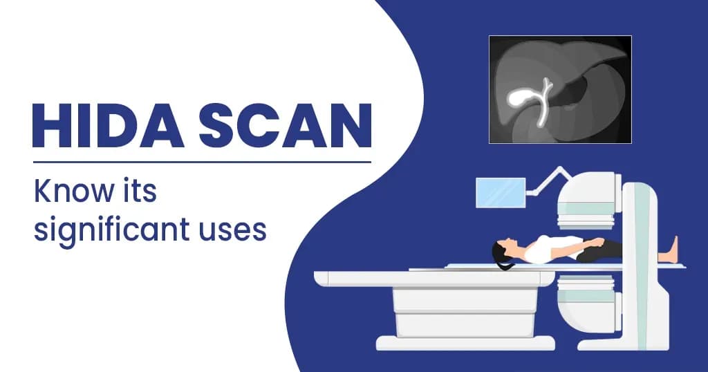 HIDA scan: Side effects, preparation & cost