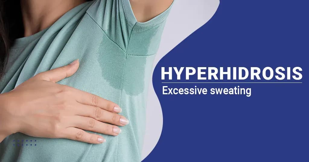 Hyperhidrosis – Causes, Symptoms, Treatments and More