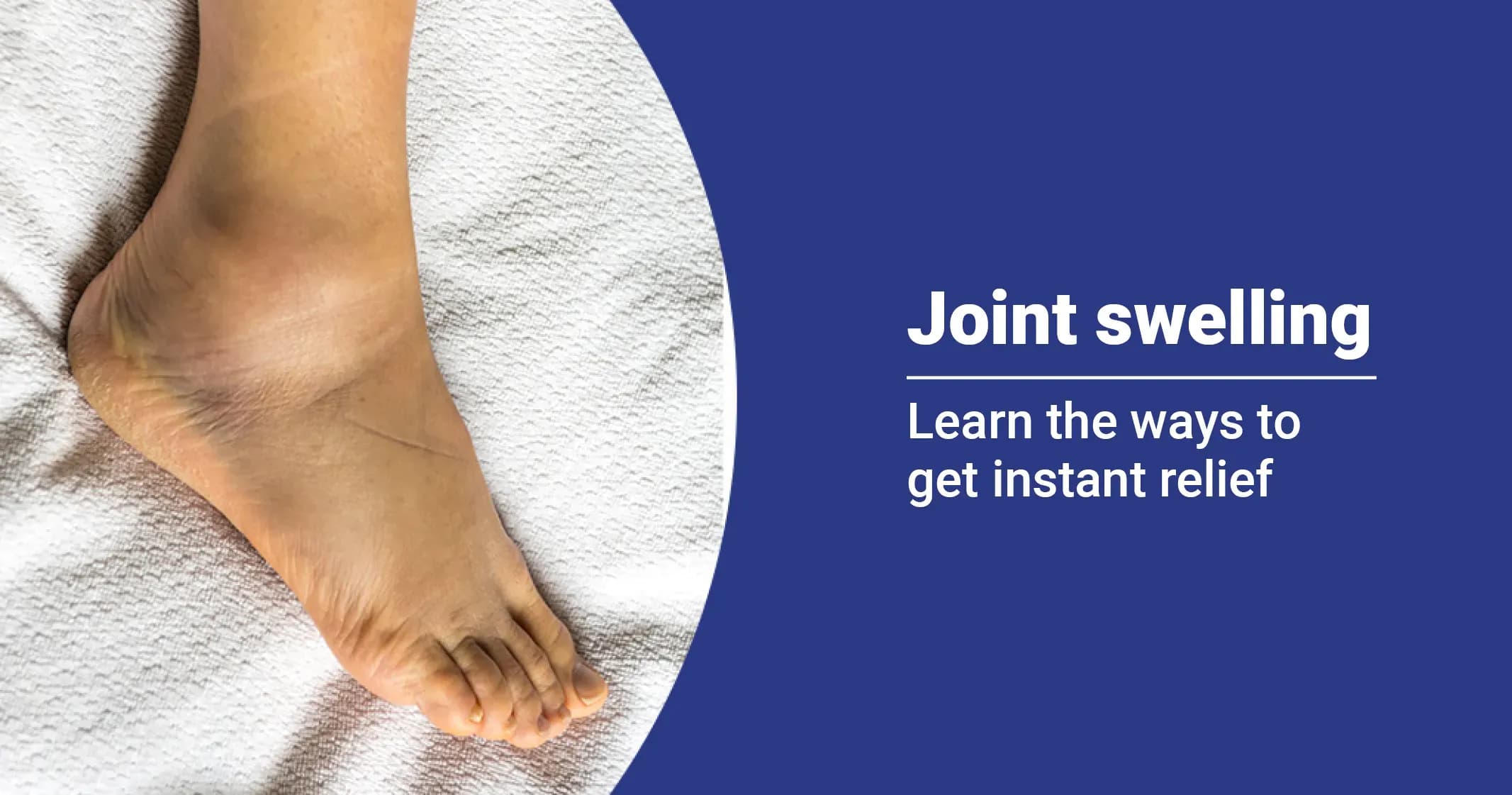 What you need to know about joint swelling