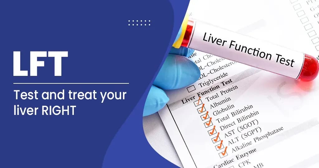 Liver Function Test (LFT) 