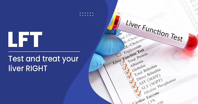 Liver Function Test (LFT)