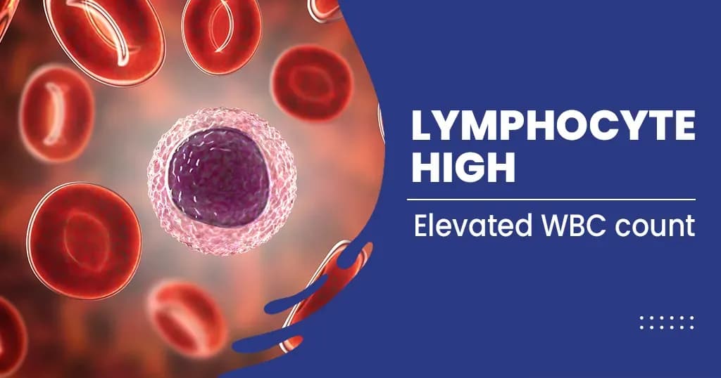 Lymphocytes High – Causes, Signs, and Symptoms