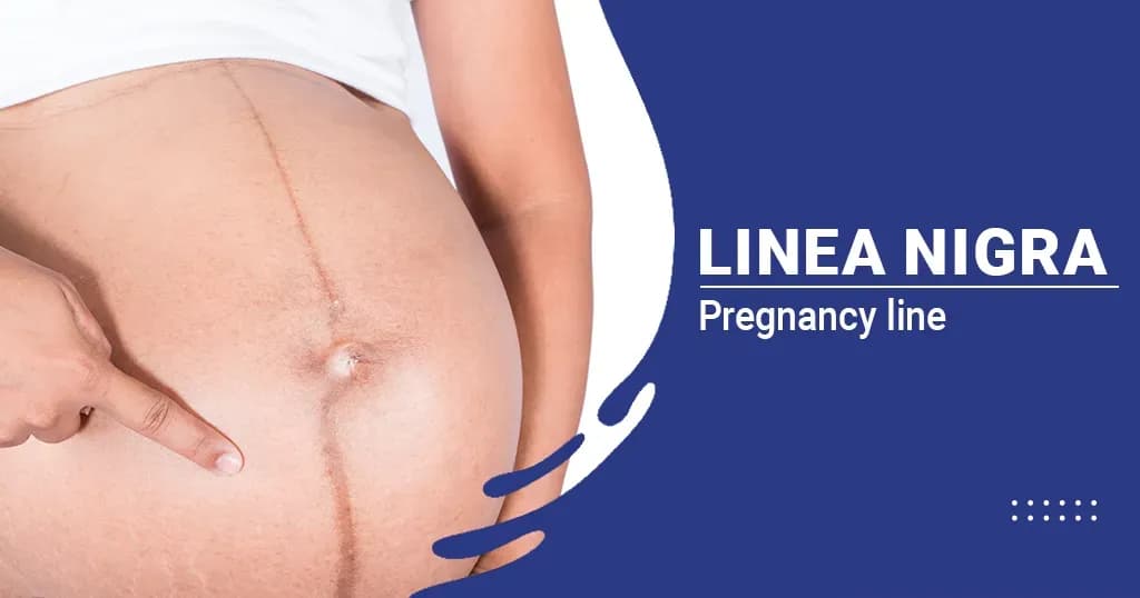 Linea nigra in Pregnancy - Causes and Prevention of the Line on stomach during Pregnancy