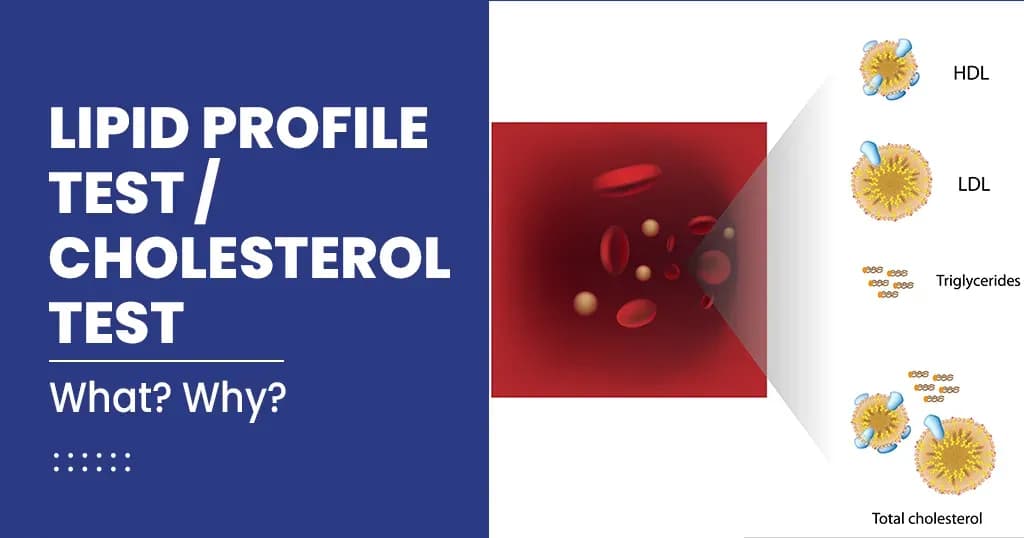 Lipid Profile