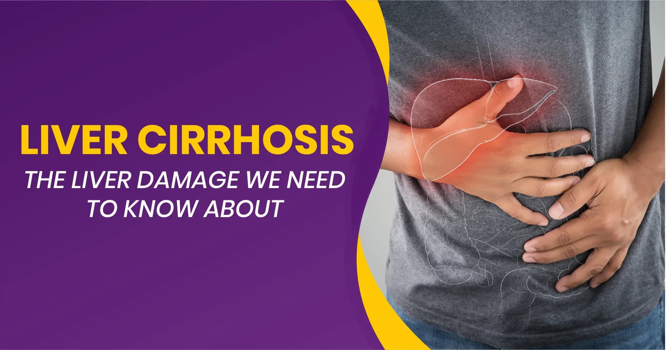 Liver cirrhosis: Stages, Causes and Symptoms