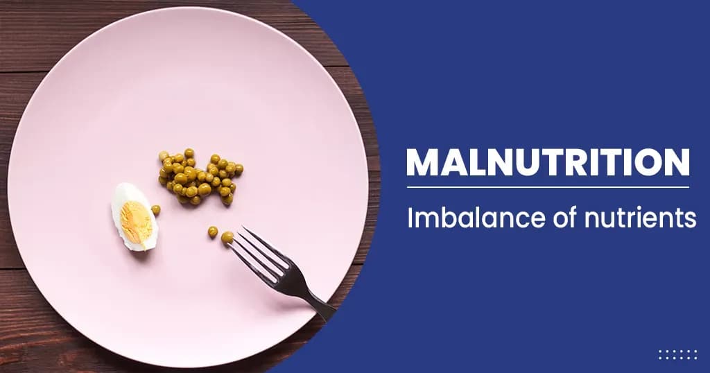 Malnutrition – Types, Causes, and Symptoms