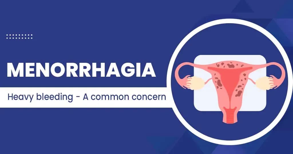 Menorrhagia - causes, symptoms and treatment