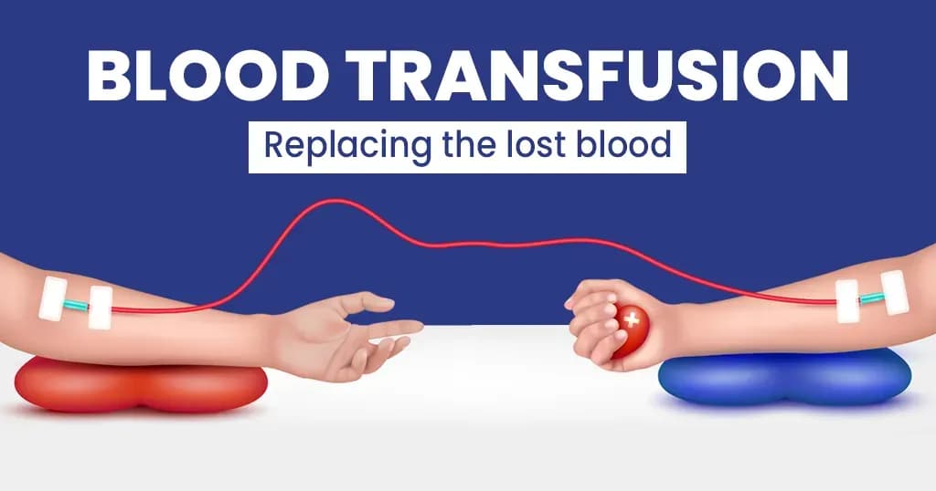 Blood transfusion: What do you need to know?